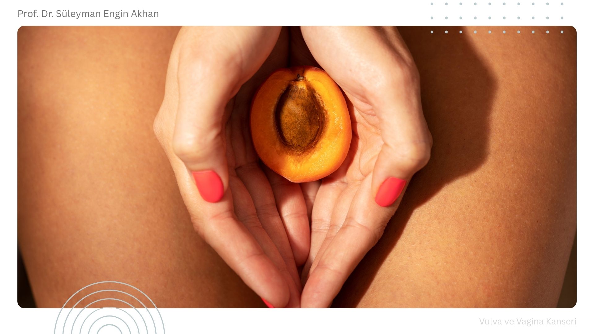 Vulva ve Vagina Kanseri
